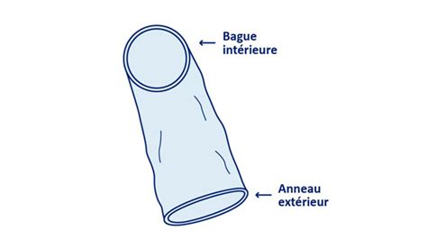 Image montrant un préservatif externe et un préservatif interne