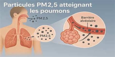 Illustration schématique des poumons montrant l'infiltration de particules fines