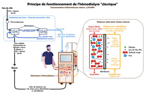 Schéma illustrant le principe de l'hémodialyse