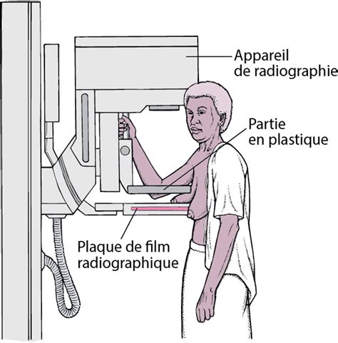 Schéma d'une mammographie 3D