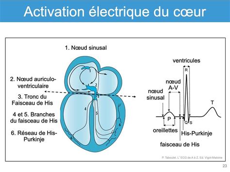 Schéma simplifié du système de conduction électrique du cœur